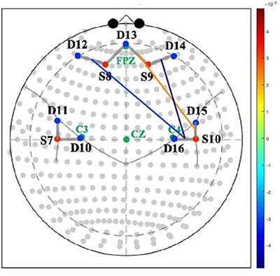 Postpartum Depression Is Associated With Altered Neural Connectivity Between Affective and Mentalizing Regions During Mother-Infant Interactions